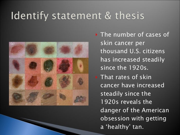 argumentative essay on skin cancer